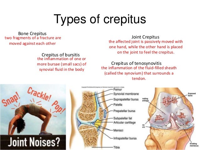 Crepitation is what Crepitation is what